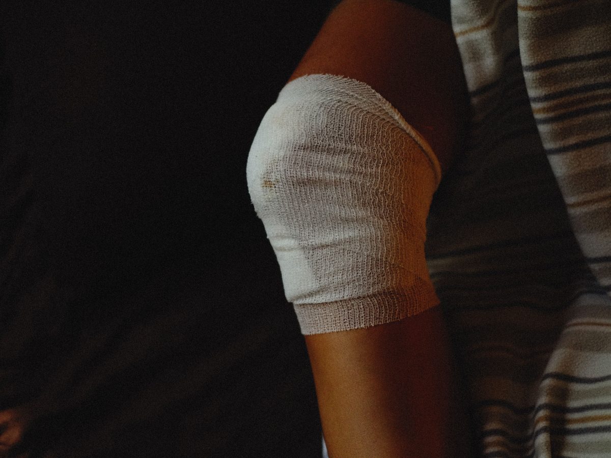 Sprained Knee Recovery Time – What You Need to Know?, Egham and Woking