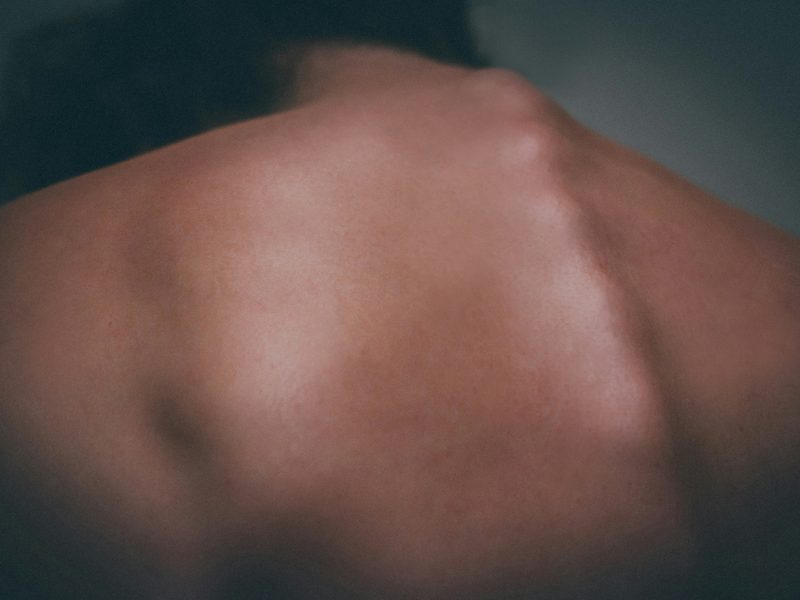 3 At Home Exercises For Cervical Spondylosis, Egham and Woking