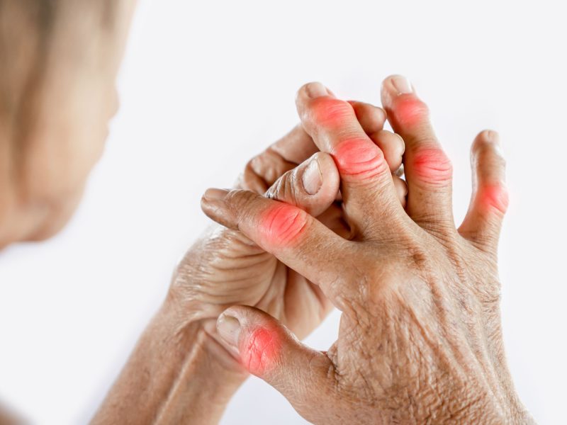 Managing Arthritis With The Changing Weather