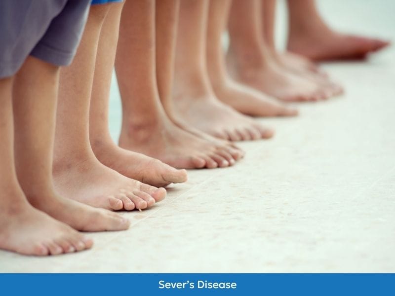 Sever's Disease