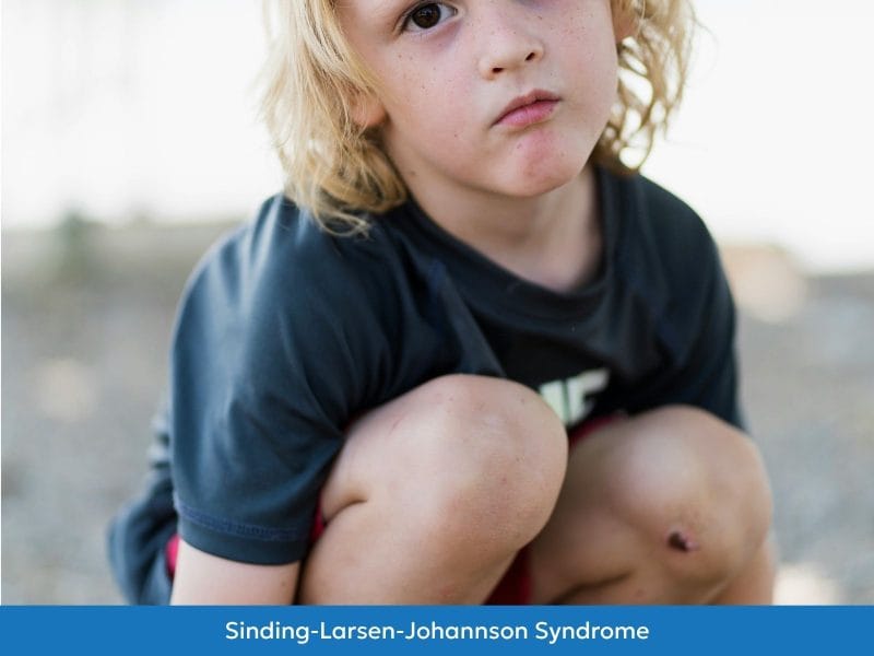 SLJ Syndrome